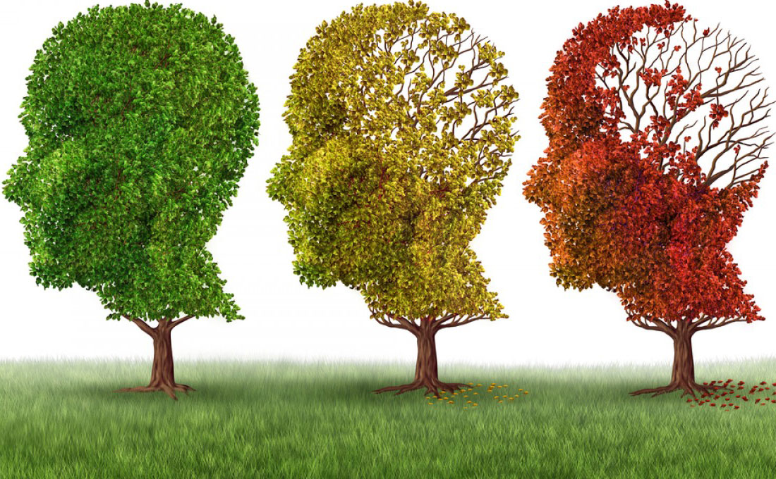 Alzheimer: Τροφές που ενισχύουν τη μνήμη μας
